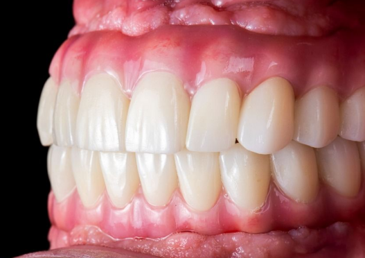 protocolos dentário dentistas moema senhor de idade