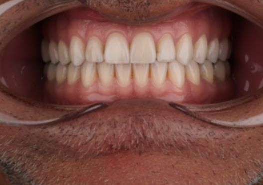 protocolos dentário dentistas moema senhor de idade