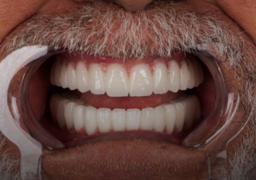 protocolos dentário dentistas moema senhor de idade